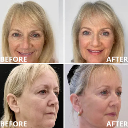 💗[Zvoevo® Official] 50% OFF ✨ Calcium Multi Balm | Anti-Aging, Firming & Wrinkle Care