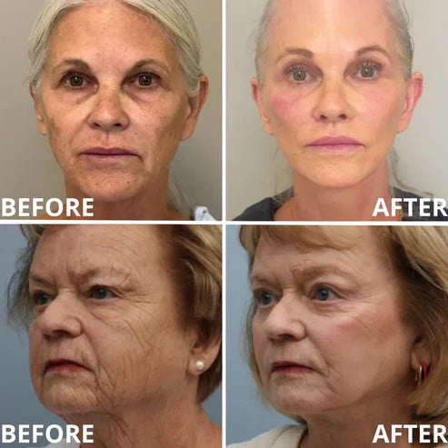 💗[Zvoevo® Official] 50% OFF ✨ Calcium Multi Balm | Anti-Aging, Firming & Wrinkle Care