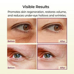 💗[Zvoevo® Official] 50% OFF ✨ Calcium Multi Balm | Anti-Aging, Firming & Wrinkle Care